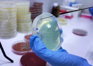 Study highlights rise in severe Shigella infections among people experiencing homelessness